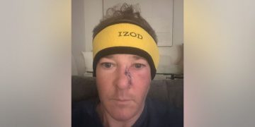 EPA administrator Lee Zeldin reveals he underwent surgery to remove skin cancer from his face